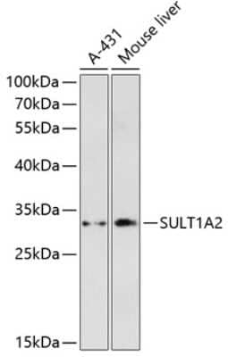 Western Blot SULT1A2 Antibody - Azide and BSA Free