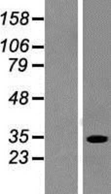Western Blot: SULT1A2 Overexpression Lysate (Adult Normal) [NBP2-05012] Left-Empty vector transfected control cell lysate (HEK293 cell lysate); Right -Over-expression Lysate for SULT1A2.