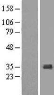 Western Blot: SULT1A3/SULT1A4 Overexpression Lysate (Adult Normal) [NBL1-16603] Left-Empty vector transfected control cell lysate (HEK293 cell lysate); Right -Over-expression Lysate for SULT1A3/SULT1A4.