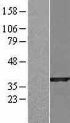 Western Blot: SULT1B1 Overexpression Lysate (Adult Normal) [NBL1-16604] Left-Empty vector transfected control cell lysate (HEK293 cell lysate); Right -Over-expression Lysate for SULT1B1.