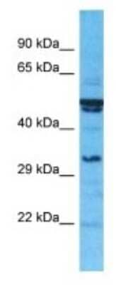 Western Blot: SULT1C3 Antibody [NBP3-09936] - Western blot analysis of SULT1C3 in 721_B Whole Cell lysates. Antibody dilution at 1.0ug/ml