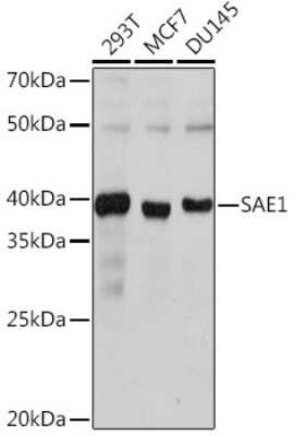 Western Blot: SUMO Activating Enzyme E1 (SAE1) Antibody (0L2N2) [NBP3-15317] - Western blot analysis of extracts of various cell lines, using SUMO Activating Enzyme E1 (SAE1) Rabbit mAb (NBP3-15317) at 1:1000 dilution. Secondary antibody: HRP Goat Anti-Rabbit IgG (H+L) at 1:10000 dilution. Lysates/proteins: 25ug per lane. Blocking buffer: 3% nonfat dry milk in TBST. Detection: ECL Basic Kit. Exposure time: 1s.