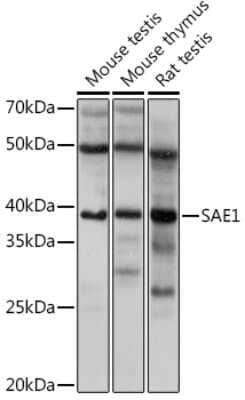 Western Blot: SUMO Activating Enzyme E1 (SAE1) Antibody (0L2N2) [NBP3-15317] - Western blot analysis of extracts of various cell lines, using SUMO Activating Enzyme E1 (SAE1) Rabbit mAb (NBP3-15317) at 1:1000 dilution. Secondary antibody: HRP Goat Anti-Rabbit IgG (H+L) at 1:10000 dilution. Lysates/proteins: 25ug per lane. Blocking buffer: 3% nonfat dry milk in TBST. Detection: ECL Basic Kit. Exposure time: 5s.