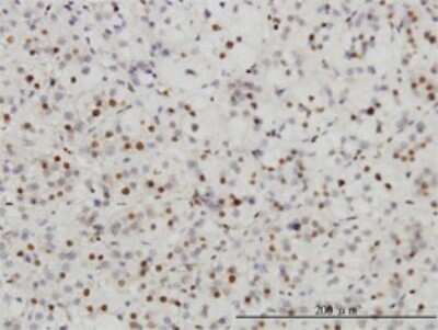Immunohistochemistry-Paraffin: SUMO Activating Enzyme E1 (SAE1) Antibody (1G4-1G5) [H00010055-M01] - Analysis of monoclonal antibody to SAE1 on formalin-fixed paraffin-embedded human adrenal gland. Antibody concentration 3 ug/ml.