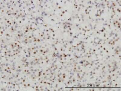 Immunohistochemistry-Paraffin: SUMO Activating Enzyme E1 (SAE1) Antibody (1G4-1G5) [H00010055-M01] - Analysis of monoclonal antibody to SAE1 on formalin-fixed paraffin-embedded human adrenal gland. Antibody concentration 3 ug/ml.