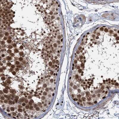 Immunohistochemistry-Paraffin: SUMO Activating Enzyme E1 (SAE1) Antibody [NBP2-13272] - Staining of human testis shows high expression.