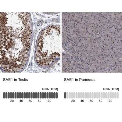 <b>Independent Antibodies Validation and Orthogonal Strategies Validation.</b>Immunohistochemistry-Paraffin: SUMO Activating Enzyme E1 (SAE1) Antibody [NBP2-13272] - Staining in human testis and pancreas tissues using anti-SAE1 antibody. Corresponding SAE1 RNA-seq data are presented for the same tissues.
