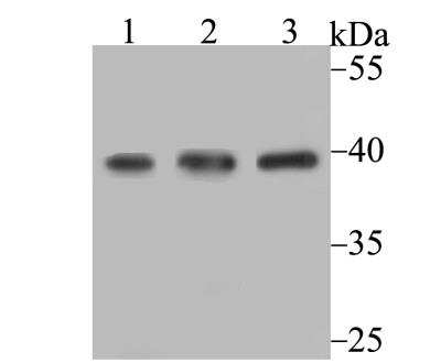 Western Blot: SUMO Activating Enzyme E1 (SAE1) Antibody (JG35-88) [NBP2-76866] - Western blot analysis of SAE1 on different cell lysates using anti-SAE1 antibody at 1/1,000 dilution.Positive control:Lane 1: SiHa Lane 2: K562Lane 3: 293