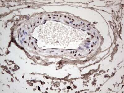 Immunohistochemistry: SUMO Activating Enzyme E1 (SAE1) Antibody (OTI6B11) - Azide and BSA Free [NBP2-74410] - Analysis of Human bladder tissue. (Heat-induced epitope retrieval by 1 mM EDTA in 10mM Tris, pH8.5, 120C for 3min)