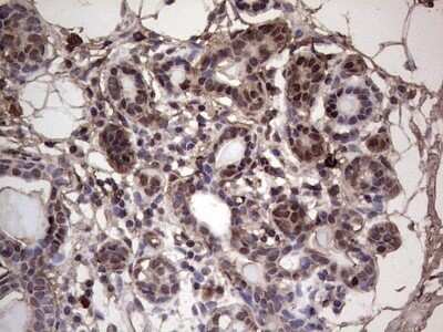 Immunohistochemistry: SUMO Activating Enzyme E1 (SAE1) Antibody (OTI6B11) - Azide and BSA Free [NBP2-74410] - Analysis of Human breast tissue. (Heat-induced epitope retrieval by 1 mM EDTA in 10mM Tris, pH8.5, 120C for 3min)
