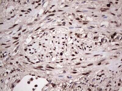 Immunohistochemistry: SUMO Activating Enzyme E1 (SAE1) Antibody (OTI6B11) - Azide and BSA Free [NBP2-74410] - Analysis of Human endometrium tissue. (Heat-induced epitope retrieval by 1 mM EDTA in 10mM Tris, pH8.5, 120C for 3min)