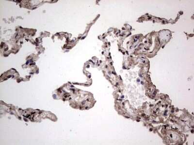 Immunohistochemistry: SUMO Activating Enzyme E1 (SAE1) Antibody (OTI6B11) - Azide and BSA Free [NBP2-74410] - Analysis of Human lung tissue. (Heat-induced epitope retrieval by 1 mM EDTA in 10mM Tris, pH8.5, 120C for 3min)