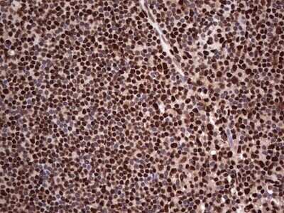 Immunohistochemistry: SUMO Activating Enzyme E1 (SAE1) Antibody (OTI6B11) - Azide and BSA Free [NBP2-74410] - Analysis of Human lymph node tissue. (Heat-induced epitope retrieval by 1 mM EDTA in 10mM Tris, pH8.5, 120C for 3min)