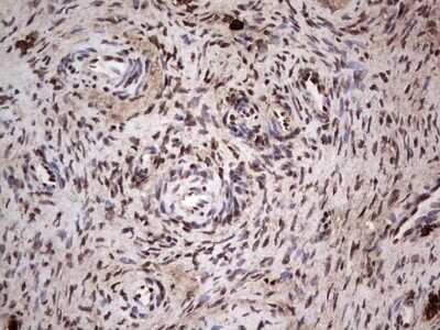 Immunohistochemistry: SUMO Activating Enzyme E1 (SAE1) Antibody (OTI6B11) - Azide and BSA Free [NBP2-74410] - Analysis of Human Ovary tissue. (Heat-induced epitope retrieval by 1 mM EDTA in 10mM Tris, pH8.5, 120C for 3min)