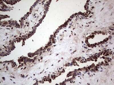 Immunohistochemistry: SUMO Activating Enzyme E1 (SAE1) Antibody (OTI6B11) - Azide and BSA Free [NBP2-74410] - Analysis of Human prostate tissue. (Heat-induced epitope retrieval by 1 mM EDTA in 10mM Tris, pH8.5, 120C for 3min)