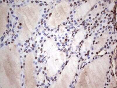 Immunohistochemistry: SUMO Activating Enzyme E1 (SAE1) Antibody (OTI6B11) - Azide and BSA Free [NBP2-74410] - Analysis of Human thyroid tissue. (Heat-induced epitope retrieval by 1 mM EDTA in 10mM Tris, pH8.5, 120C for 3min)