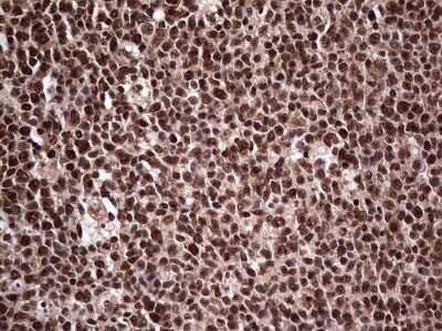 Immunohistochemistry: SUMO Activating Enzyme E1 (SAE1) Antibody (OTI6B11) - Azide and BSA Free [NBP2-74410] - Analysis of Human tonsil tissue. (Heat-induced epitope retrieval by 1 mM EDTA in 10mM Tris, pH8.5, 120C for 3min)