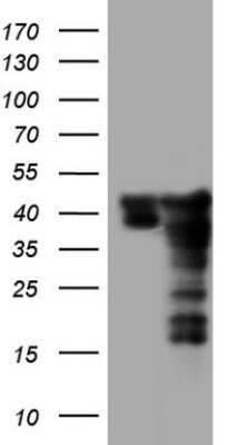 Western Blot SUMO Activating Enzyme E1 (SAE1) Antibody (OTI6B11) - Azide and BSA Free