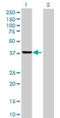 Western Blot: SUMO Activating Enzyme E1 (SAE1) Antibody [H00010055-B01P] - Analysis of SAE1 expression in transfected 293T cell line by SAE1 polyclonal antibody.  Lane 1: SAE1 transfected lysate(38.06 KDa). Lane 2: Non-transfected lysate.