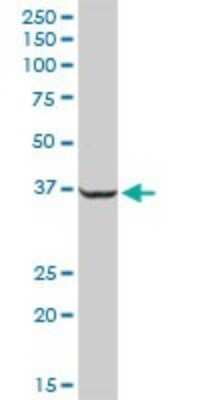 Western Blot: SUMO Activating Enzyme E1 (SAE1) Antibody [H00010055-D01P] - Analysis of SAE1 expression in human liver.