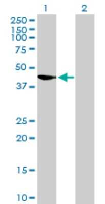 Western Blot: SUMO Activating Enzyme E1 (SAE1) Antibody [H00010055-D01P] - Analysis of SAE1 expression in transfected 293T cell line by SAE1 polyclonal antibody.Lane 1: SAE1 transfected lysate(38.40 KDa).Lane 2: Non-transfected lysate.