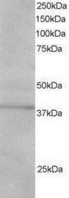 Western Blot: SUMO Activating Enzyme E1 (SAE1) Antibody [NB100-1312] - (1ug/ml) of Jurkat lysate (RIPA buffer, 30ug total protein per lane). Primary incubated for 1 hour. Detected by western blot using chemiluminescence.