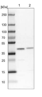 Western Blot: SUMO Activating Enzyme E1 (SAE1) Antibody [NBP2-13272] - Lane 1: NIH-3T3 cell lysate (Mouse embryonic fibroblast cells). Lane 2: NBT-II cell lysate (Rat Wistar bladder tumor cells).