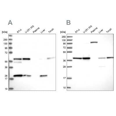 Western Blot: SUMO Activating Enzyme E1 (SAE1) Antibody [NBP2-13272] - Analysis using Anti-SAE1 antibody NBP2-13272 (A) shows similar pattern to independent antibody NBP2-13273 (B).