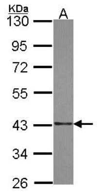 Western Blot: SUMO Activating Enzyme E1 (SAE1) Antibody [NBP2-20251] - Sample (30 ug of whole cell lysate) A: A549 10% SDS PAGE gel, diluted at 1:1000.