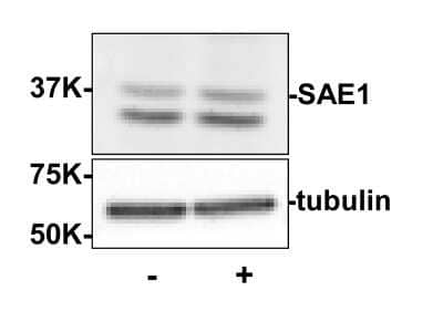 Western Blot: SUMO Activating Enzyme E1 (SAE1) Antibody [NBP2-44220] - Left lane (-):  20 ug human HeLa whole cell protein. Right lane (+):  20 ug human HeLa whole cell protein from cells pre-treated with phosphatase inhibitor cocktail to prevent dephosphorylation of the target. Proteins were separated on a 10% SDS-PAGE and transferred onto nitrocellulose. After blocking with 5% milk-TBST 1 hr at room temperature, the membrane was probed with SUMO Activating Enzyme E1 (SAE1) Antibody (2 ug/mL) at room temperature for 3 hr followed by washes and reaction with HRP-conjugated secondary and ECL imaging.