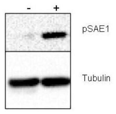 Western Blot: SUMO Activating Enzyme E1 (SAE1) [p Ser185] Antibody [NBP1-78069] - SUMO Activating Enzyme E1 (SAE1) antibody contains 20 ug human HeLa whole cell protein. Right lane (+) contains 20 ug human HeLa whole cell protein from cells pre-treated with phosphatase inhibitor cocktail to prevent de-phosphorylation of the target. Proteins were separated on a 10% SDS-PAGE and transferred onto nitrocellulose. After blocking with 5% milk-TBST 1 hr at room temperature, the membrane was probed with the primary antibody diluted to 2 ug/mL at room temperature for 3 hr followed by washes and reaction with HRP-conjugated secondary and ECL imaging.