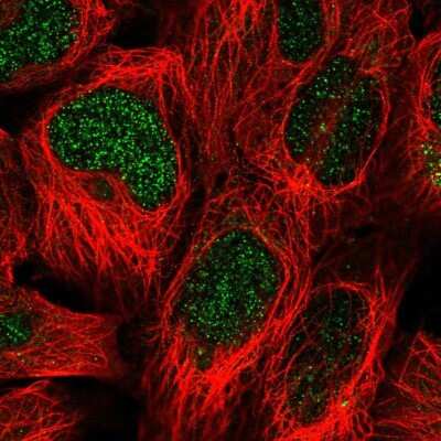 Immunocytochemistry/Immunofluorescence: SUMO-interacting Motif (SIM) Antibody [NBP2-30700] - Staining of human cell line HEK 293 shows localization to nucleus. Antibody staining is shown in green.
