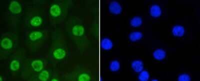 Immunocytochemistry/Immunofluorescence: SUMO1 Antibody (SJ20-03) [NBP2-67419] - Staining SUMO-1 in A549 cells (green). The nuclear counter stain is DAPI (blue). Cells were fixed in paraformaldehyde, permeabilised with 0.25% Triton X100/PBS.