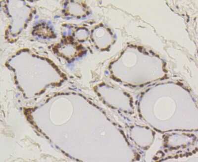 Immunohistochemistry-Paraffin: SUMO1 Antibody (SJ20-03) [NBP2-67419] - Analysis of paraffin-embedded human thyroid tissue using anti-SUMO-1 antibody. Counter stained with hematoxylin.