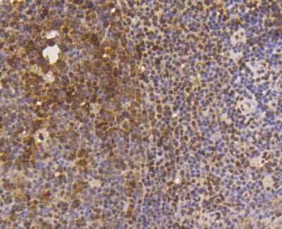 Immunohistochemistry-Paraffin: SUMO1 Antibody (SJ20-03) [NBP2-67419] - Analysis of paraffin-embedded human tonsil tissue using anti-SUMO-1 antibody. Counter stained with hematoxylin.