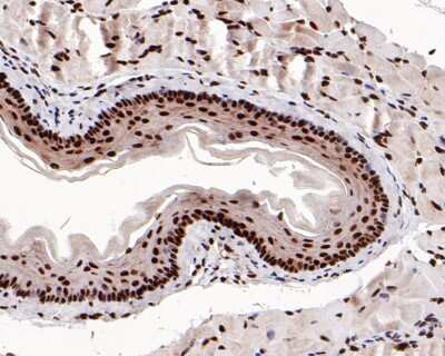 Immunohistochemistry-Paraffin: SUMO1 Antibody (SJ20-03) [NBP2-67419] - Analysis of paraffin-embedded mouse esophagus tissue with Rabbit anti-SUMO1 antibody washed with ddH2O and PBS, and then probed with the primary antibody at 1/500 dilution for 1 hour at room temperature. The detection was performed using an HRP conjugated compact polymer system. DAB was used as the chromogen. Tissues were counterstained with hematoxylin and mounted with DPX.
