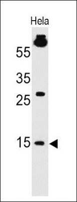 Western Blot: SUMO1 Antibody (SM1/495) - Azide and BSA Free [NBP2-34716] - analysis of SUMO1 in human HeLa Cell lysate