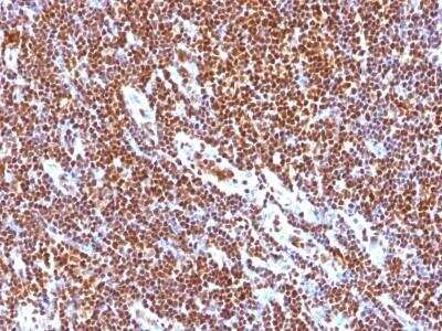 Immunohistochemistry-Paraffin: SUMO1 Antibody (SUMO1/1188) - Azide and BSA Free [NBP2-47697] - Human Tonsil stained with SUMO-1 Monoclonal Antibody (SUMO1/1188