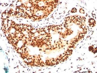 Immunohistochemistry-Paraffin: SUMO2/3 Antibody (SM23/496) - IHC-Prediluted [NBP2-45335] - Formalin-fixed, paraffin-embedded human tonsil stained with SUMO-2 MAb (SM23/496)