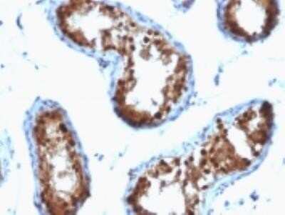 Immunohistochemistry-Paraffin: SUMO2/3 Antibody (SPM572) - IHC-Prediluted [NBP2-45336] - Formalin-fixed, paraffin-embedded human Testicular carcinoma stained with SUMO-2 Monoclonal Antibody (SPM572)