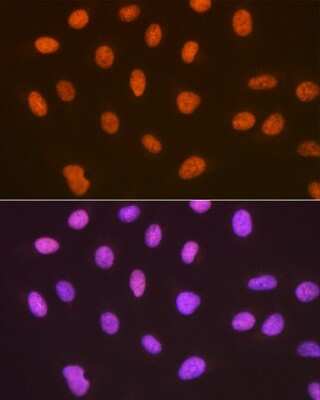 Immunocytochemistry/Immunofluorescence: SUMO4 Antibody (7X3V7) [NBP3-16732] - Immunofluorescence analysis of U-2 OS cells using SUMO4 Rabbit mAb (NBP3-16732) at dilution of 1:100 (40x lens). Blue: DAPI for nuclear staining.