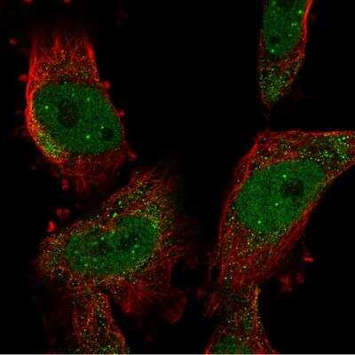 Immunocytochemistry/Immunofluorescence: SUMO4 Antibody [NBP2-34073] - Staining of human cell line U-251 MG shows localization to nucleoplasm, nuclear bodies & cytosol. Antibody staining is shown in green.