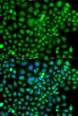 Immunocytochemistry/Immunofluorescence: SUMO4 Antibody [NBP2-93213] - Analysis of A549 cells using SUMO4 . Blue: DAPI for nuclear staining.