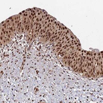 Immunohistochemistry-Paraffin: SUMO4 Antibody [NBP2-34073] - Staining of human urinary bladder shows strong nuclear positivity in urothelial cells.