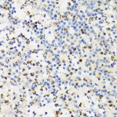 Immunohistochemistry-Paraffin: SUMO4 Antibody [NBP2-95198] - Paraffin-embedded human appendicitis using SUMO4 .