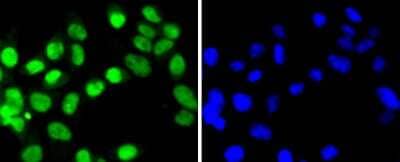 Immunocytochemistry/Immunofluorescence: SUMO4 Antibody (JJ085-01) [NBP2-67906] - Staining SUMO4 in 293 cells (green). The nuclear counter stain is DAPI (blue). Cells were fixed in paraformaldehyde, permeabilised with 0.25% Triton X100/PBS.