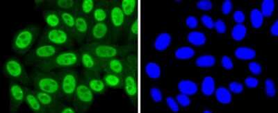 Immunocytochemistry/Immunofluorescence: SUMO4 Antibody (JJ085-01) [NBP2-67906] - Staining SUMO4 in HepG2 cells (green). The nuclear counter stain is DAPI (blue). Cells were fixed in paraformaldehyde, permeabilised with 0.25% Triton X100/PBS.