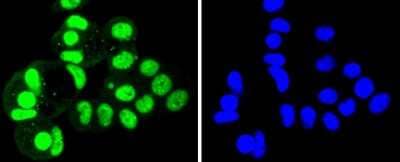 Immunocytochemistry/Immunofluorescence: SUMO4 Antibody (JJ085-01) [NBP2-67906] - Staining SUMO4 in MCF-7 cells (green). The nuclear counter stain is DAPI (blue). Cells were fixed in paraformaldehyde, permeabilised with 0.25% Triton X100/PBS.