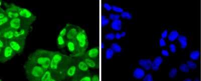 Immunocytochemistry/Immunofluorescence: SUMO4 Antibody (JJ085-01) [NBP2-67906] - Staining SUMO4 in RH-35 cells (green). The nuclear counter stain is DAPI (blue). Cells were fixed in paraformaldehyde, permeabilised with 0.25% Triton X100/PBS.