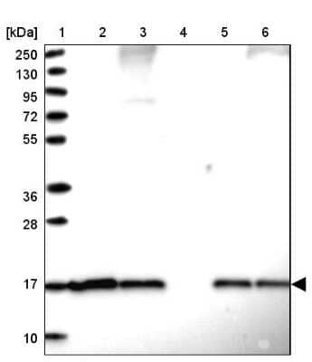 Western Blot: SUMO4 Antibody [NBP2-34073] - Lane 1: Marker  [kDa] 250, 130, 95, 72, 55, 36, 28, 17, 10.  Lane 2: Human cell line RT-4.  Lane 3: Human cell line U-251MG sp.  Lane 4: Human plasma (IgG/HSA depleted).  Lane 5: Human liver tissue.  Lane 6: Human tonsil tissue